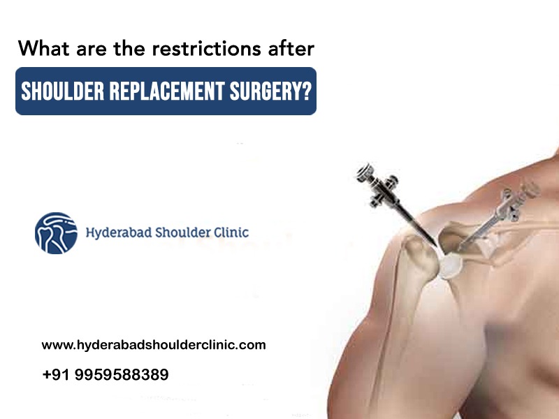 What are the restrictions after shoulder replacement surgery?
